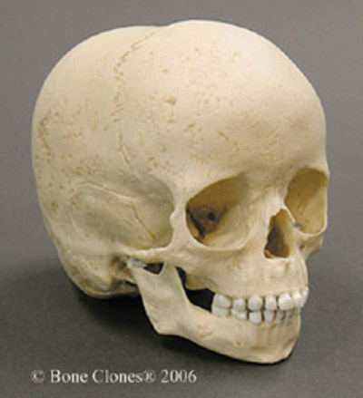 5歳の子供頭骨(8000年前）